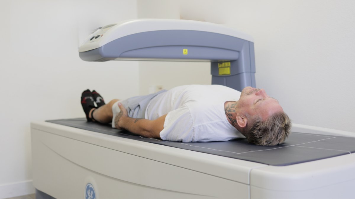 DEXA Scan Los Alamitos: Precision Body Composition for High-Performance Wellness